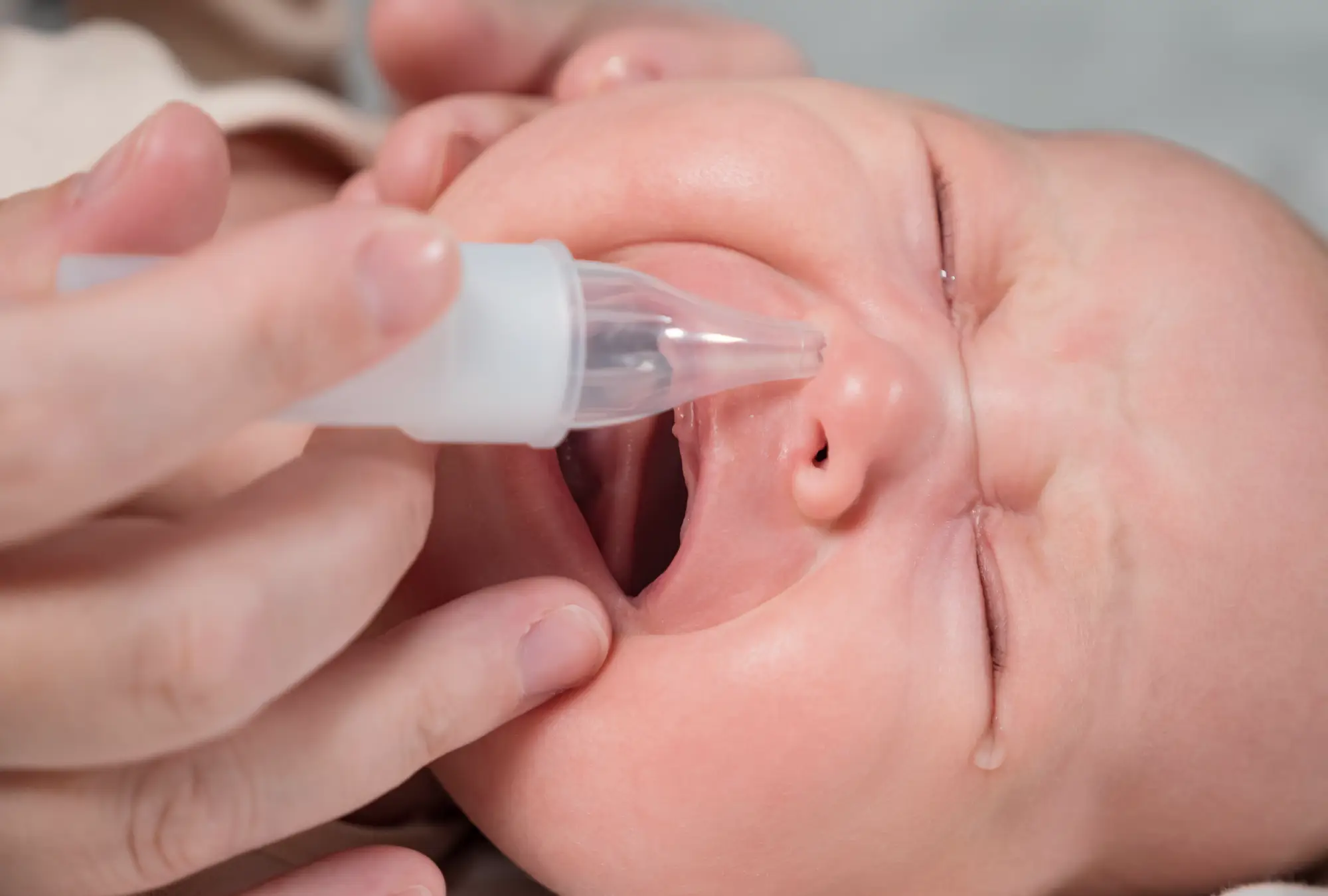 Fotografía en primer plano de un recien nacido con mocos y una madre limpiandolos