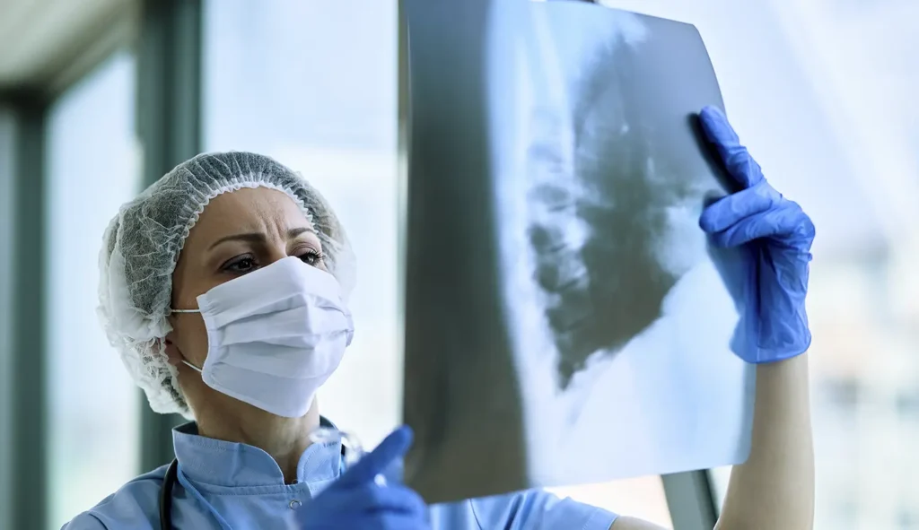 Fotografía de una mujer medico con mascarilla observando una radiorafía del torax en busca de complicaciones pulmonares