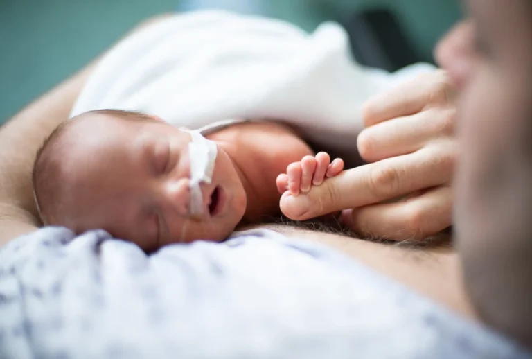 Fotografía de un bebe neonato con tratamiento de oxigeno por una displasia broncopulmonar