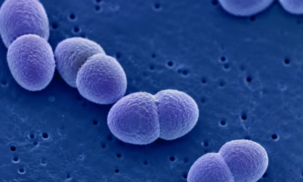 Imagen de la bacteria del neumococo que causa la neumonía típica