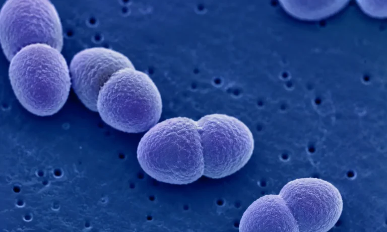 Imagen de la bacteria del neumococo que causa la neumonía típica
