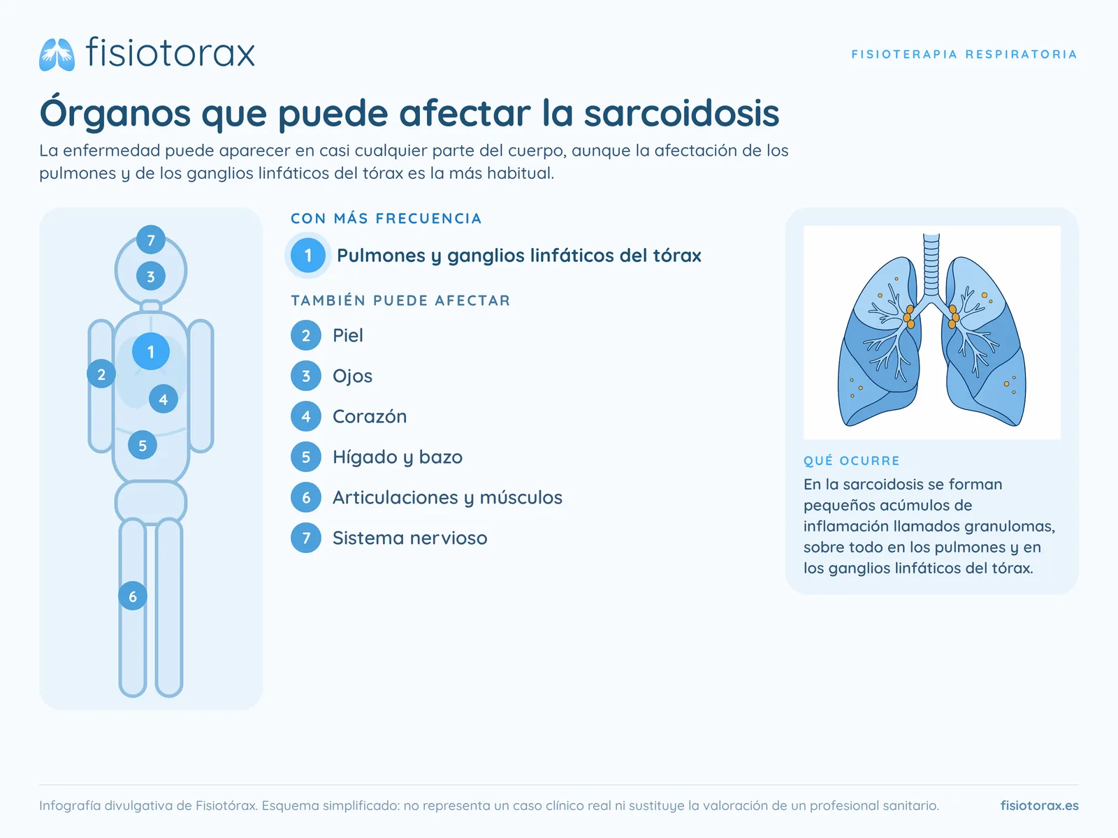 Órganos que puede afectar la sarcoidosis: pulmones y ganglios linfáticos del tórax, piel, ojos, corazón, hígado y bazo, articulaciones y músculos, y sistema nervioso