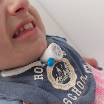 Fotografía en primer plano de una paciente traqueotomizada